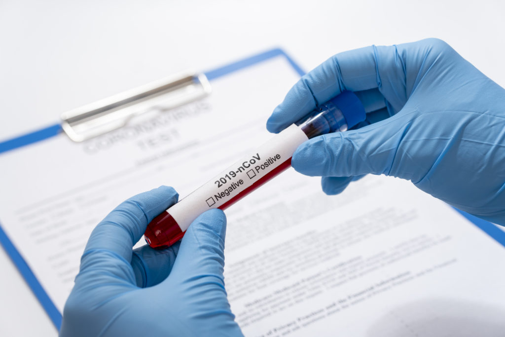Coronavirus. Le AVV. PATRUNO: Coronavirus. Le AVV. PATRUNO: